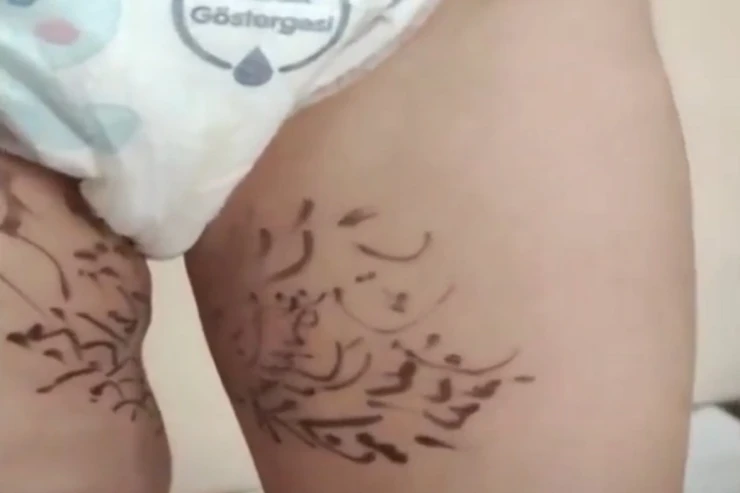 Azərbaycanda RƏZALƏT:  Dəmrov xəstəliyini sağaltmaq üçün mollaya dua yazdırdılar - VİDEO 