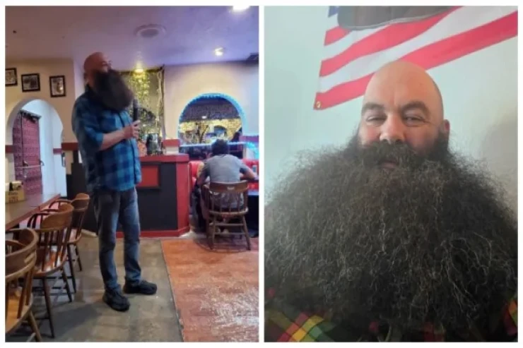 Dünyanın  ən uzun saqqal   sahibi dondurma və şorba  yeyə bilmir