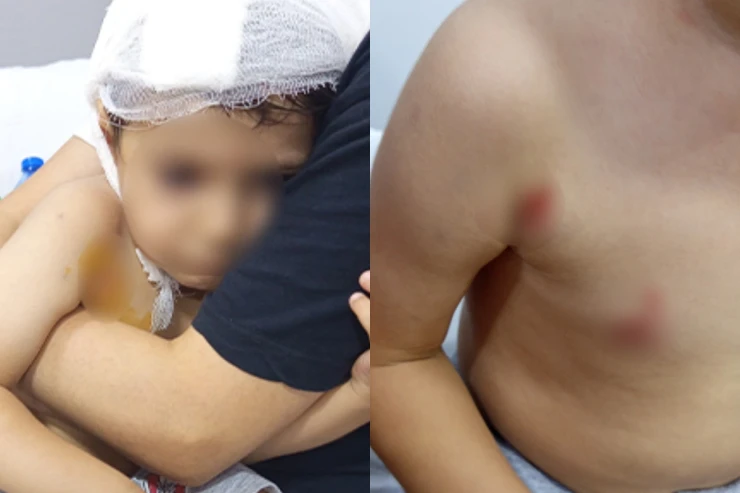 Masazırda 2 yaşlı uşağı it dişlədi -FOTOLENT 