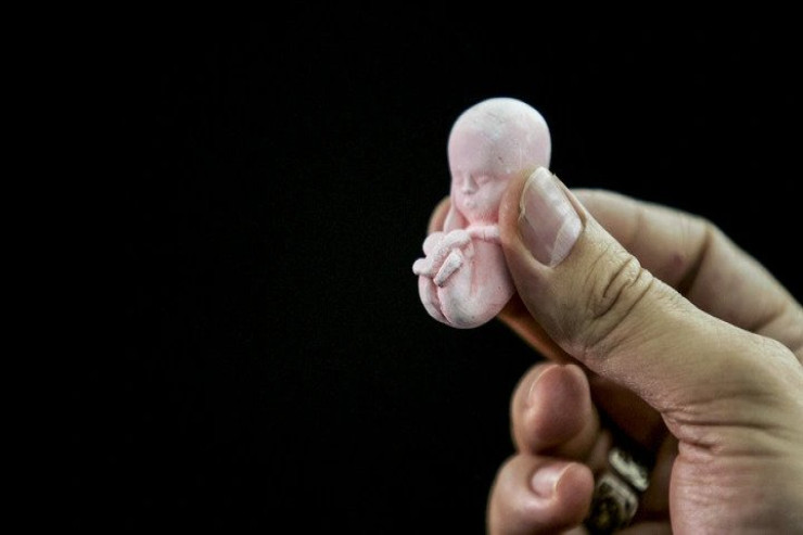 Azərbaycanda ŞOK:  72 yeniyetmə abort etdirib 