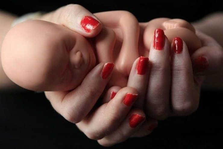 Yeniyetmələrin ABORTU:  çox qorxulu prosesdir – Həkim danışdı 