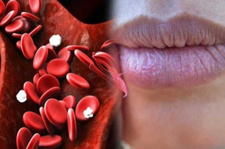 Anemiyanın qarşısını necə almaq olar? – Həkim DANIŞIR 