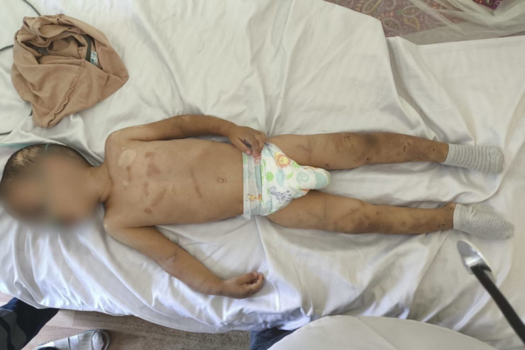 Ağdamda DƏHŞƏT:  ata 2 yaşlı uşağını ölümcül döydü - YENİLƏNİB 