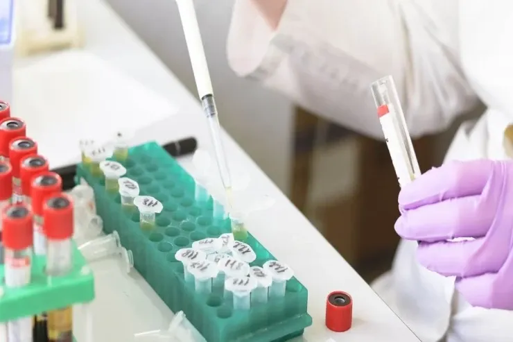 İnsult riskini artıran  qan qrupu