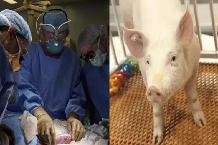 60 gündən çoxdur donuz böyrəyi ilə  yaşayır