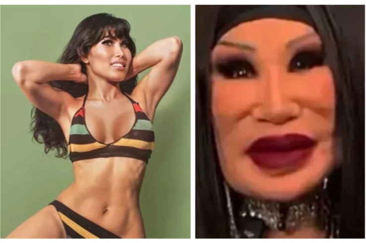 Məşhur aktrisa  tanınmaz halda:   Üzünə  “yemək yağı”   vurdurub