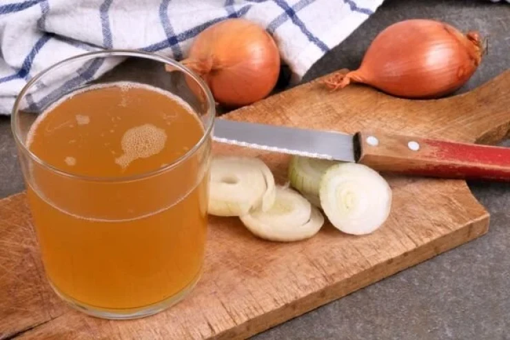 Saç tökülməsinin qarşısını almağa  kömək edəcək ev vasitəsi: Soğan SUYU  