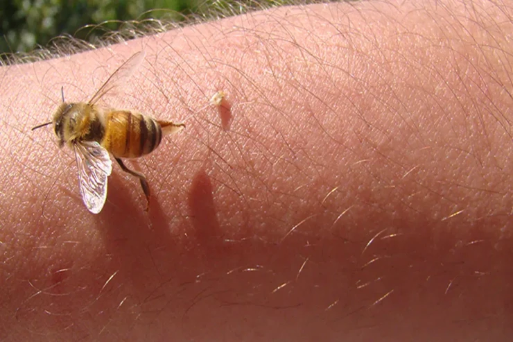 Ailə FACİƏSİ:  Kişini arı sancıb öldürdü,  arvadı infarkt keçirdi 