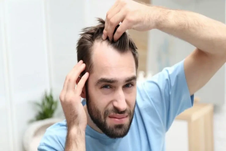 Saç tökülməsinin  inqilabi həlli:   dərman və ya saç əkimi tələb olunmur 