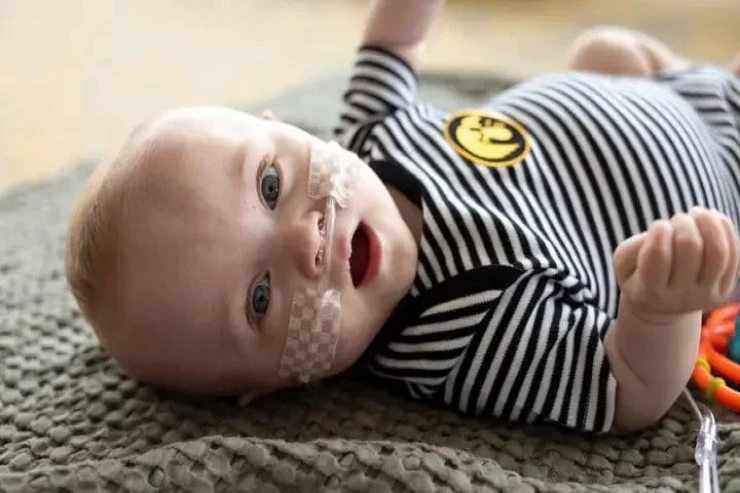 Dünyanın ən vaxtından əvvəl doğulan   körpəsi 1 yaşını qeyd etdi 