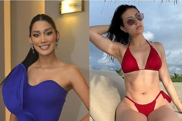 Ölkənin ən gözəl qızı toyu ərəfəsində öldü 