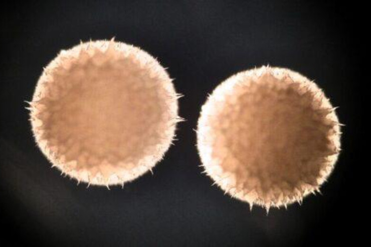 Qocalmanı yavaşladan dərman tapıldı 