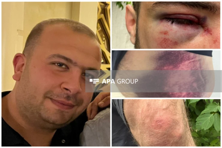 Anama şillə vurdular, atamın qabırğalarını qırıb, bizi 1 saat döydülər - Səfərovlar ailəsi DANIŞDI  - VİDEO 