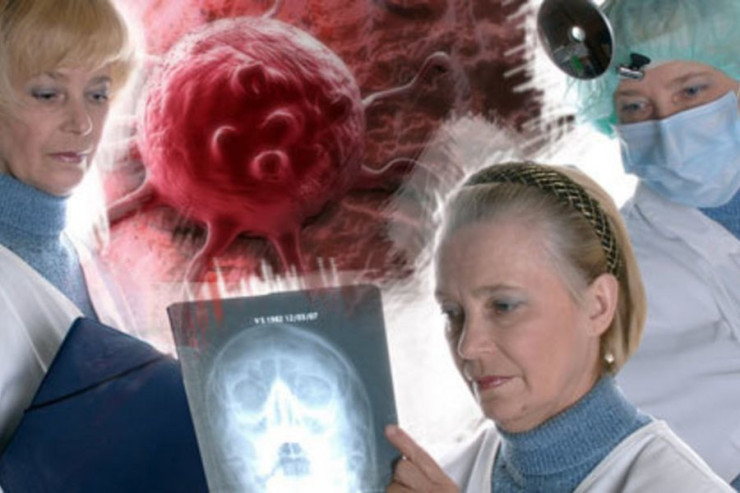 Ən ölümcül  xərçəng növü   AÇIQLANDI