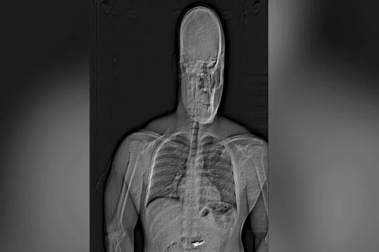 ABŞ-da maraqlı oğurluq:  769 min dollarlıq sırğaları udaraq qaçdı 