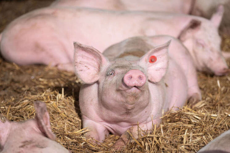 Beyin ölümü olan insana donuz qaraciyəri  köçürüldü - İLK DƏFƏ 