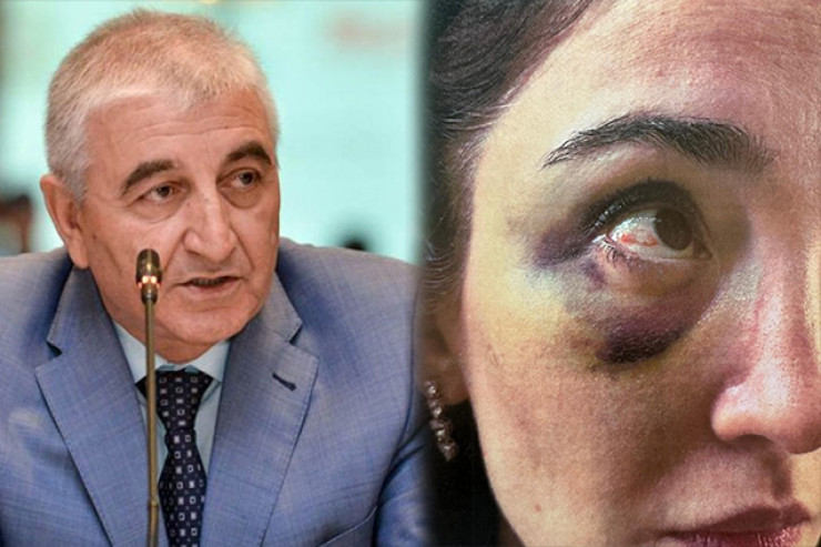 Məzahir Pənahovun oğlu arvadına işgəncə verdi - ŞOK FOTOLAR 