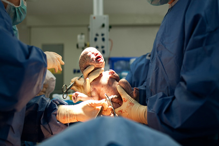 Azərbaycanda FACİƏ:  18 yaşlı qadın qeysəriyyə əməliyyatından  sonra öldü