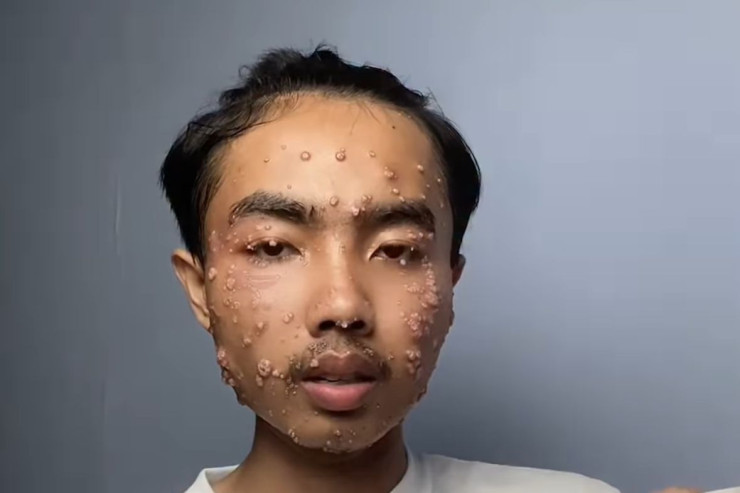 İkinci əl geyim aldı,  nadir xəstəliyə  TUTULDU