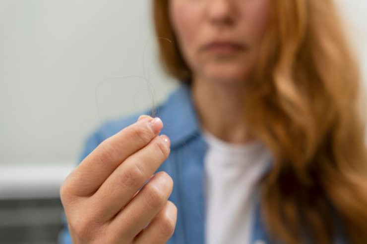 Saçınız tökülür?  - Dərhal bunları edin