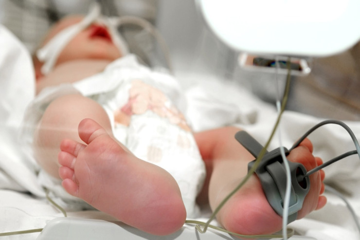 Xırdalanda FACİƏ:  1 yaşlı uşaq yandı 