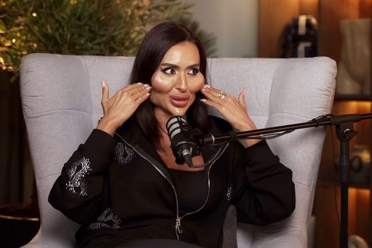 Dünyanın ən böyük yanaqlı  qadını fotosunu paylaşdı