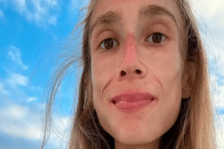 Yalnız meyvə yeyən  gənc öldü: çəkisi nə qədər idi? 