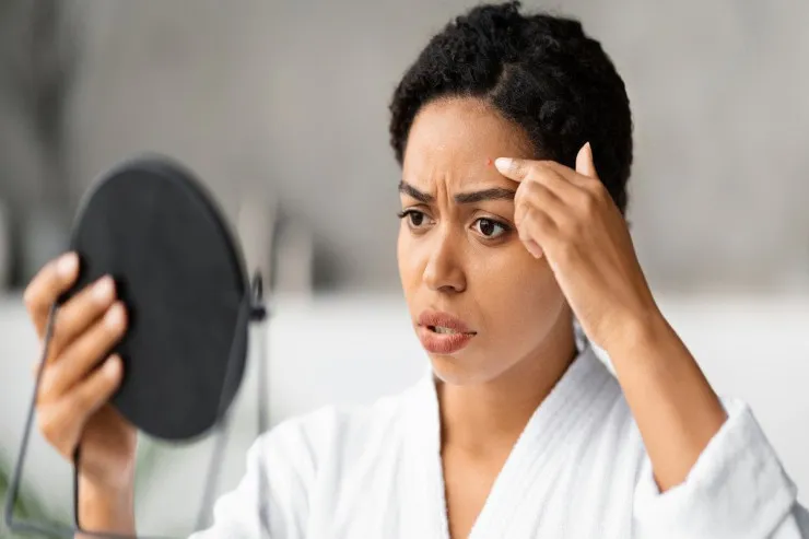 Niyə dəri ən çox payızda  əziyyət çəkir, nə etməli? Ekspert MƏSLƏHƏTİ 