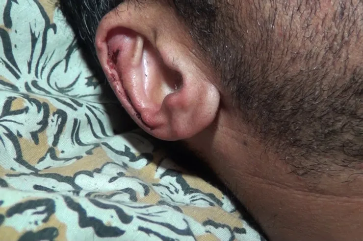 Ayı heyvan otaran Quba sakininə hücum etdi 