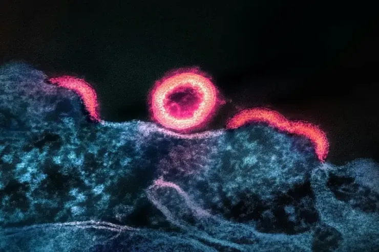 40 min illik virusu  "oyatdılar" - yeni pandemiya  başlaya bilər 