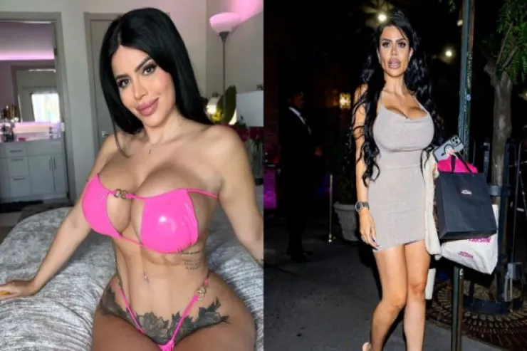 100 min xərcləyib plastik əməliyyatdan  imtina etdi: təbii gözəlliyi  üçün