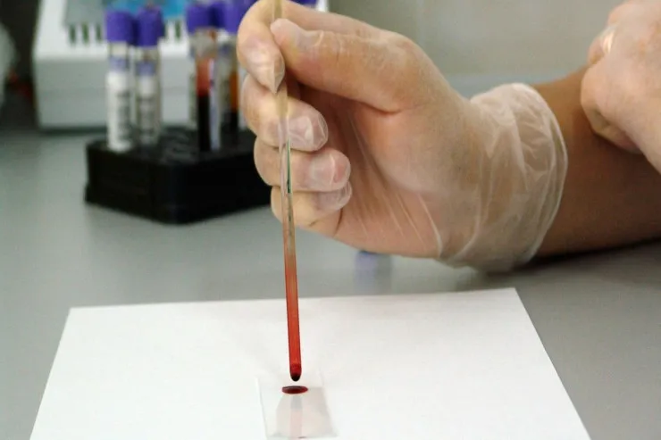 Onkoloji  sıçrayış:   Bir qan testi  onlarla xərçəng növünü   aşkar edə bilər