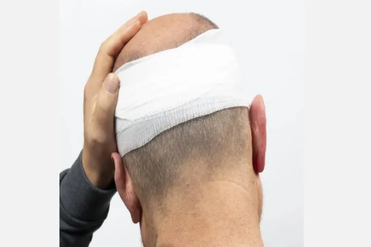 Bakıda DƏHŞƏT:  kişinin başını yardı