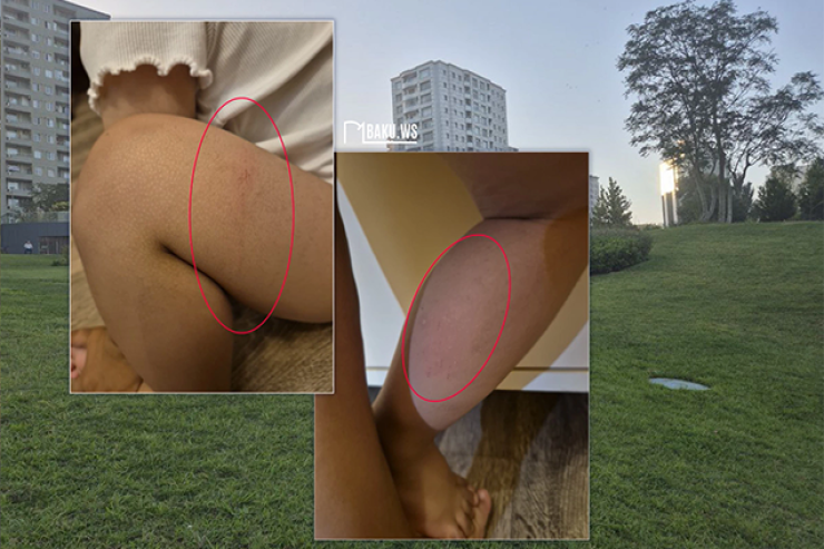 “Mərkəzi Park”da 2 yaşlı uşaq kanalizasiya quyusuna düşdü -FOTO 