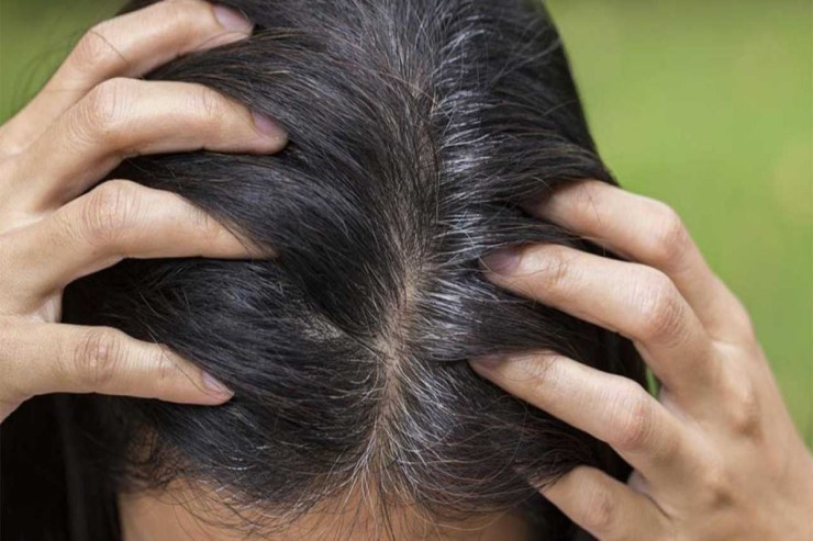 Saçdakı ağ tellərə qarşı ev üsulu maska 