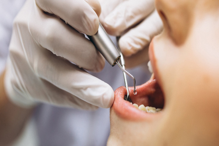 Məşhur diş həkimi arvadını onlarla qadınla  ALDATDI: intim anları gizlicə videoya  çəkdi