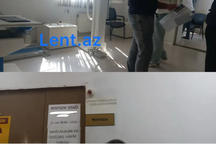 Binənin 1 xəstəxanası var, orada da növbədən yer yox - Rentgen otağına 5 nəfər daxil olur 