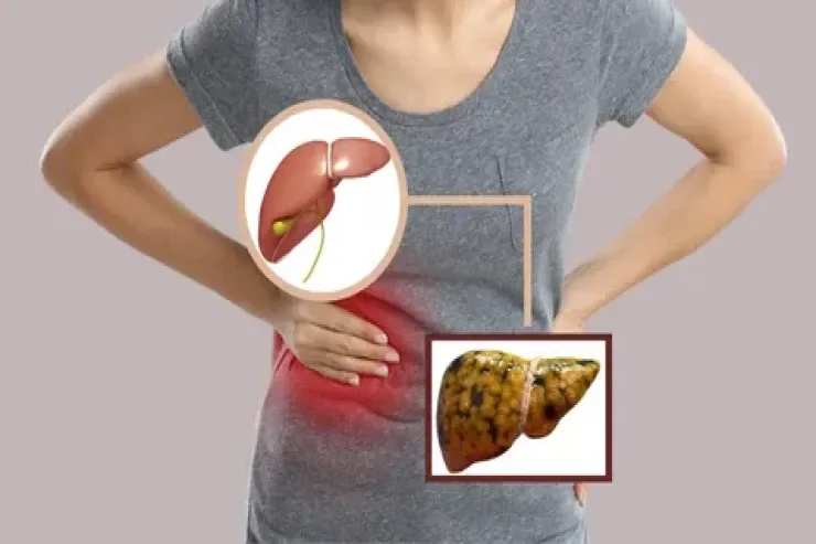 Qaraciyərin yağlanmasına səbəb olan MƏHSULLAR 