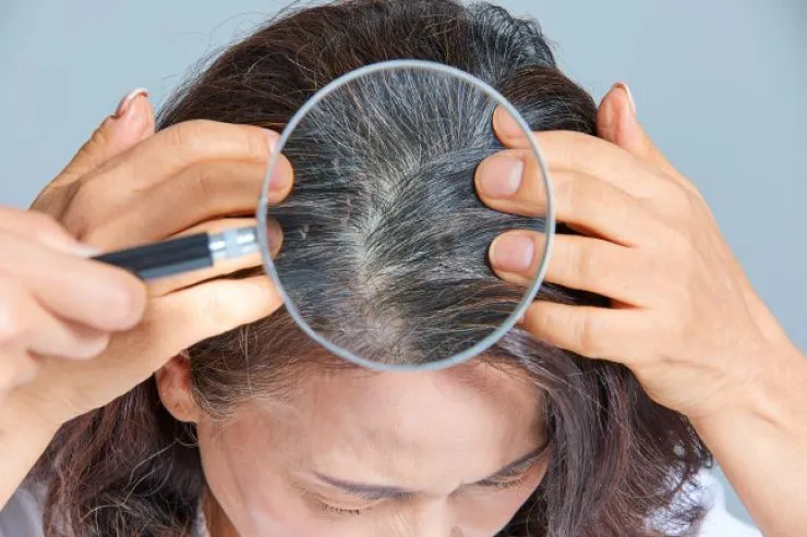 Cəmi 1 saniyəyə ağ saçları necə gizlətmək olar? 