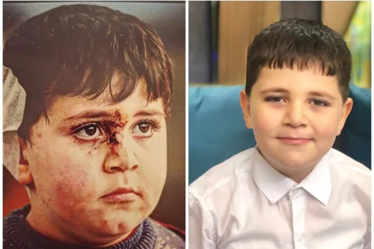 Gəncə terrorunda zərərçəkən Bəxtiyar:  Ən böyük arzum Prezidentlə görüşmək idi 