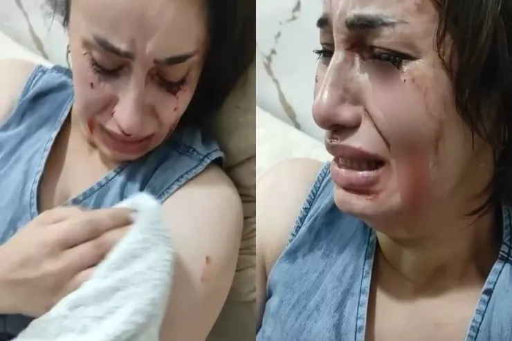 "Sən ölməlisən deyib hücum çəkdi" - Sevgilisinin bıçaqladığı lazeroloq DANIŞDI 