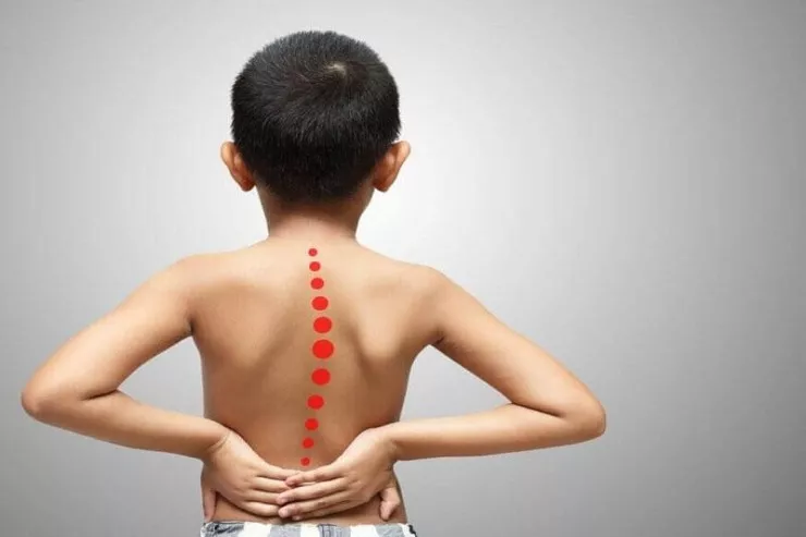 Uşaqlarda skoliozu necə müəyyən edək? - Radioloqla müsahibə  