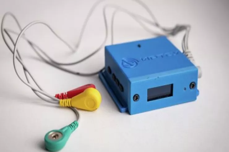 İnfarktın yaxınlaşmasından  XƏBƏRDARLIQ edən cihaz hazırlandı 