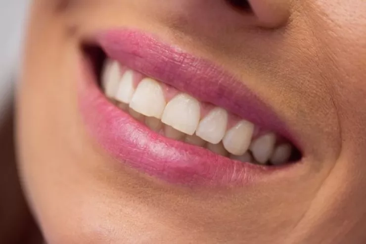 Dişlərinizin sağlam qalması  üçün hər yeməkdən sonra  bunları edin