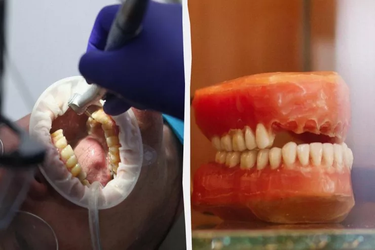Əlvida, implantlar:  Yeni dişlərin çıxması üçün  dərman sınaqları   başladı